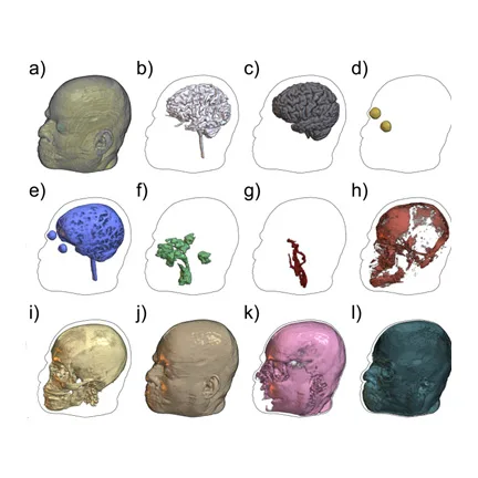 3D rendering of the 11 tissue masks as visualized in MRIcroGL