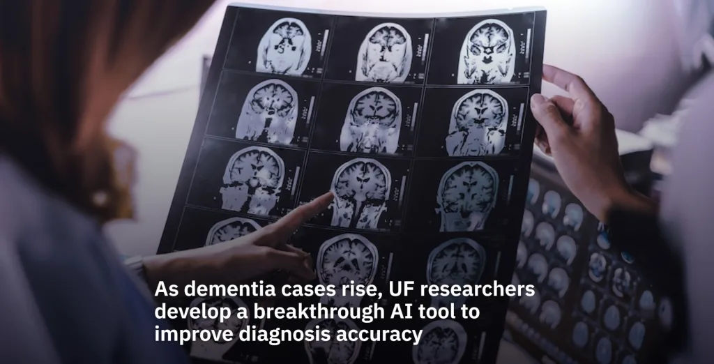 Researchers review brain MRI scans displayed on a medical imaging film.